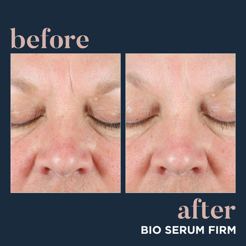 Neocutis Bio Serum Firm