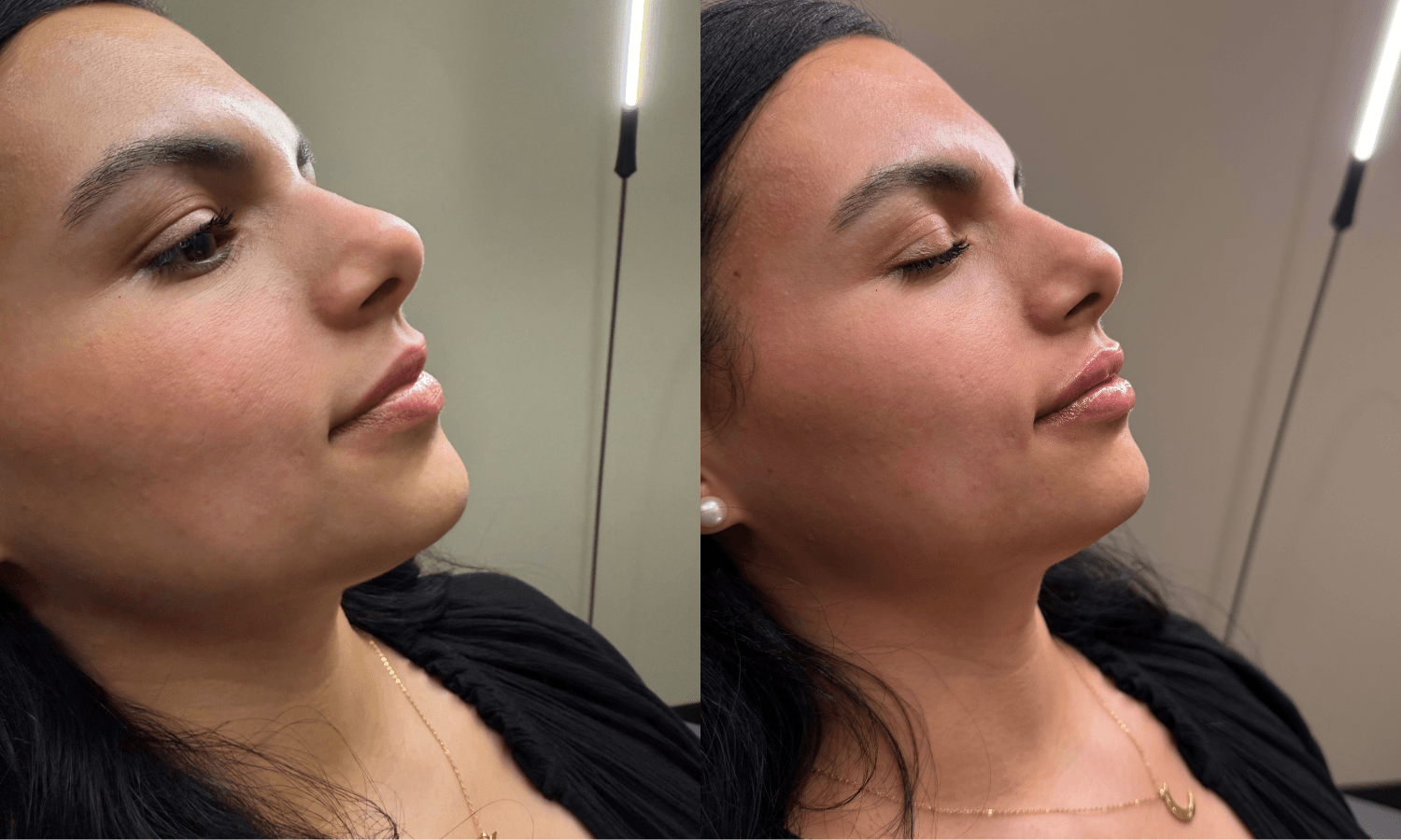 Aesthetics Ad - $100 Off FIller 2 Untitled design 1