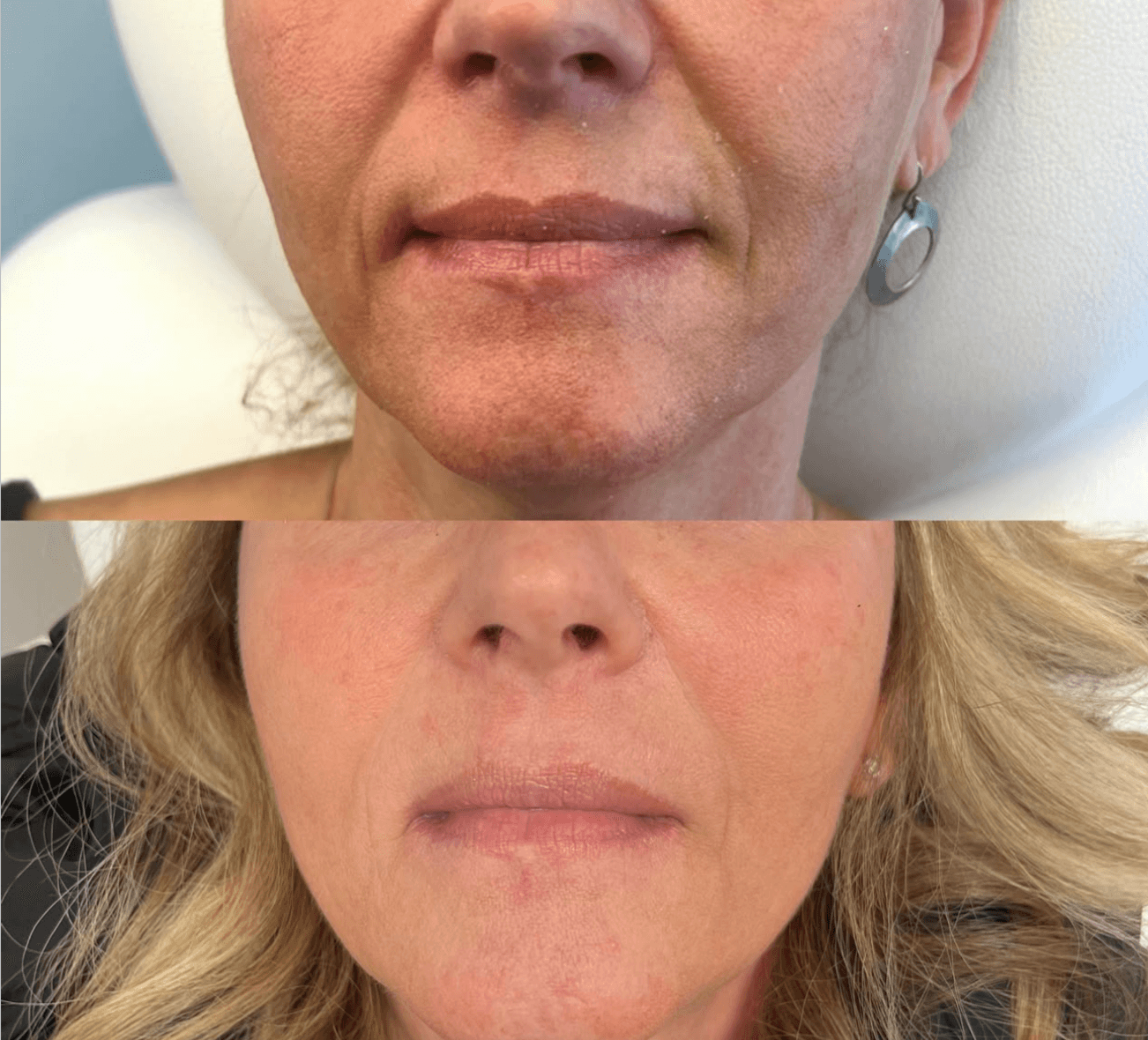 Injectables 2 Services Images 2